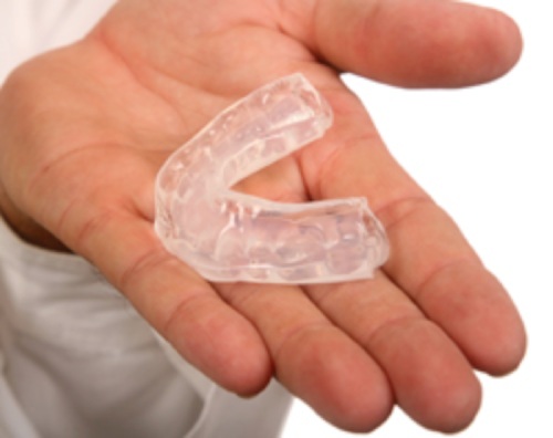 Custom dental mouthguard for protecting teeth